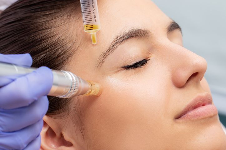 MESOTHERAPY